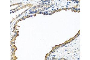 Immunohistochemistry of paraffin-embedded Human prostate using NYX Polyclonal Antibody at dilution of 1:100 (40x lens). (Nyctalopin antibody)