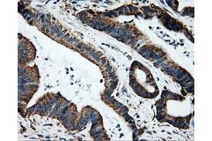 Immunohistochemical staining of paraffin-embedded Kidney tissue using anti-HSD17B10mouse monoclonal antibody.