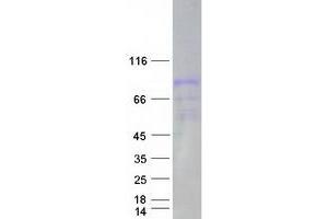 Western Blotting (WB) image for Macrophage Stimulating 1 (Hepatocyte Growth Factor-Like) (MST1) protein (Myc-DYKDDDDK Tag) (ABIN2725117)