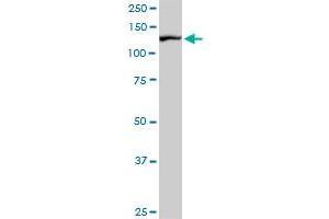 CAND1 monoclonal antibody (M02), clone 5F2. (CAND1 antibody  (AA 1-100))