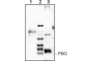Image no. 1 for anti-Porphobilinogen-Deaminase (PBG) (HemC ) antibody (ABIN334586)