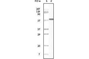 Western Blot showing CK1 antibody used against truncated CK1 recombinant protein. (CSNK1A1 antibody)