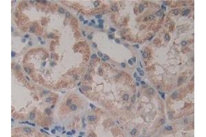 Detection of GSTt2 in Human Kidney Tissue using Polyclonal Antibody to Glutathione S Transferase Theta 2 (GSTt2) (GSTT2 antibody  (AA 15-235))