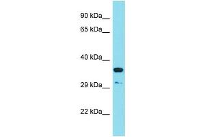 Host: Rabbit Target Name: RSPO3 Sample Type: HT1080 Whole Cell lysates Antibody Dilution: 1. (R-Spondin 3 antibody  (C-Term))