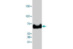 Western blot analysis from 40 ug HeLa nuclear extracts using MECP2 polyclonal antibody  at 1:1000 dilution.