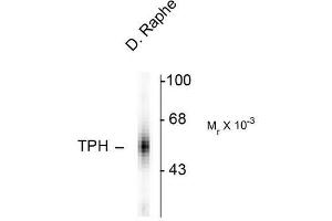 Image no. 1 for anti-Tryptophan Hydroxylase 1 (TPH1) antibody (ABIN372730) (Tryptophan Hydroxylase 1 antibody)