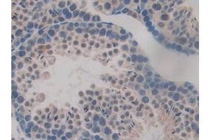Detection of TTK in Mouse Testis Tissue using Polyclonal Antibody to TTK Protein Kinase (TTK) (Mps1 antibody  (AA 527-786))
