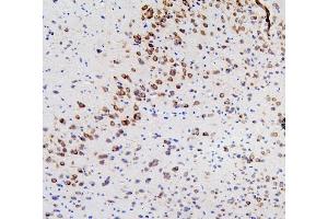 IHC analysis of RET using anti-RET antibody (ABIN6719502). (Ret Proto-Oncogene antibody  (AA 29-304))