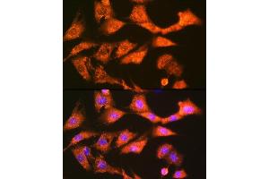 Immunofluorescence analysis of NIH-3T3 cells using GSTK1 Rabbit mAb (ABIN7267442) at dilution of 1:100 (40x lens). (GSTK1 antibody)