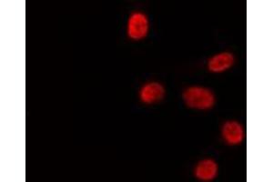 ABIN6278024 staining HepG2 by IF/ICC. (HLF antibody)