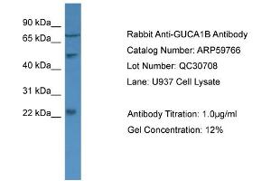 WB Suggested Anti-GUCA1B  Antibody Titration: 0. (GUCA1B antibody  (N-Term))
