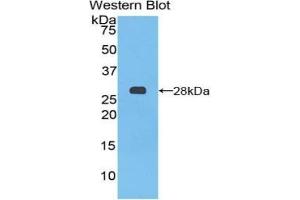 Detection of Recombinant PTCH1, Mouse using Polyclonal Antibody to Patched Homolog 1 (PTCH1) (Patched 1 antibody  (AA 213-422))