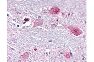 Anti-NR1D1 antibody IHC of human brain, neurons and glia. (NR1D1 antibody  (Internal Region))