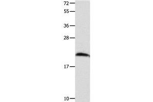 Western Blot analysis of Mouse brain tissue using FGF12 Polyclonal Antibody at dilution of 1:700 (FGF12 antibody)