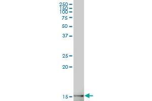 GABARAPL2 polyclonal antibody (A01), Lot # 060519JCS1 Western Blot analysis of GABARAPL2 expression in 293 . (GABARAPL2 antibody  (AA 31-117))