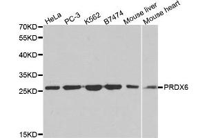 Western blot analysis of extracts of various cell lines, using PRDX6 antibody. (Peroxiredoxin 6 antibody)