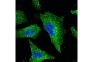 Immunofluorescent analysis of Beta-tubulin staining in Hela cells. (TUBB antibody)