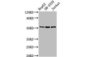 Western Blot Positive WB detected in: HepG2 whole cell lysate, SH-SY5Y whole cell lysate, Jurkat whole cell lysate All lanes: PRKN antibody at 3 μg/mL Secondary Goat polyclonal to rabbit IgG at 1/50000 dilution Predicted band size: 52, 49, 24, 31, 43, 36, 44, 47 kDa Observed band size: 52 kDa (Parkin antibody  (AA 1-465))