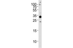 Western blot analysis of HeLa lysate and RPS6 antibody used at 1:1000. (RPS6 antibody  (AA 1-30))