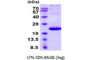 SDS-PAGE (SDS) image for Interleukin 29 (IL29) (AA 20-200) (Active) protein (His tag) (ABIN5777971)