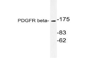 Western blot (WB)analyzes of PDGFR beta antibody in extracts from NIH/3T3 cells. (PDGFRB antibody)