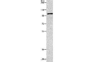 Western blot analysis of 231 cell, using TNK2 Polyclonal Antibody at dilution of 1:1800 (TNK2 antibody)