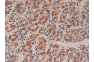 #VALUE! (Intrinsic Factor antibody  (AA 198-413))