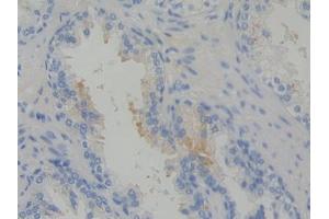 DAB staining on IHC-P; Samples: Human Prostate Tissue (Arc antibody  (AA 96-356))
