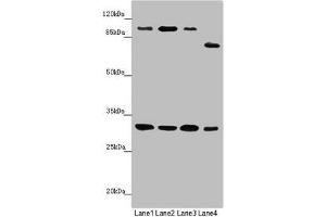 Western blot All lanes: MTIF3 antibody at 1. (MTIF3 antibody  (AA 1-278))