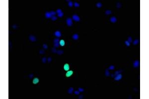Immunofluorescence staining of MCF-7 cells with ABIN7127308 at 1:56,counter-stained with DAPI. (Recombinant HIST1H1E antibody  (pThr17))