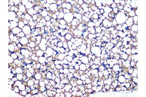 Immunohistochemistry (IHC) image for anti-Perilipin 1 (PLIN1) antibody (ABIN7269218)
