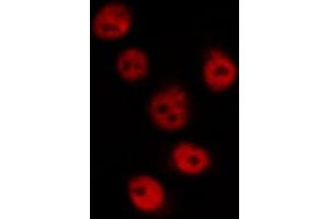 ABIN6269162 staining HeLa by IF/ICC. (CREB1 antibody  (Internal Region))