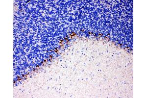 Anti-GABA Transporter 1/GAT 1 antibody, IHC(P) IHC(P): Rat Brain Tissue (SLC6A1 antibody  (C-Term))