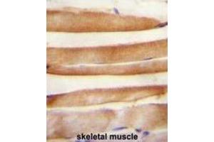 Immunohistochemistry (IHC) image for anti-ARV1 Homolog (ARV1) antibody (ABIN2995757) (ARV1 antibody)