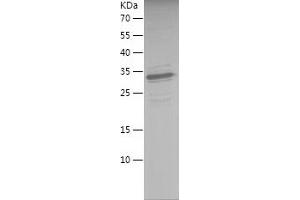 Western Blotting (WB) image for SMAD, Mothers Against DPP Homolog 1 (SMAD1) (AA 1-250) protein (His tag) (ABIN7125121) (SMAD1 Protein (AA 1-250) (His tag))