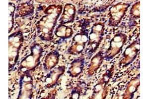 Immunohistochemistry of paraffin-embedded human small intestine tissue using ABIN7158996 at dilution of 1:100 (MARK3 antibody  (AA 368-667))