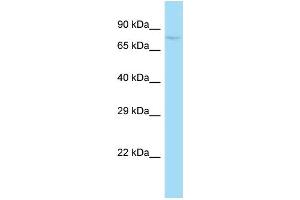 WB Suggested Anti-Sugp1 Antibody   Titration: 1.