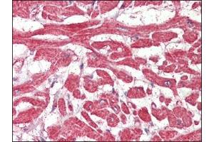 Heart, Human: Formalin-Fixed, Paraffin-Embedded (FFPE) (FABP7 antibody  (C-Term))