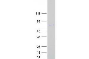 Western Blotting (WB) image for Translocation Protein 1 (TLOC1) protein (Myc-DYKDDDDK Tag) (ABIN2731581)