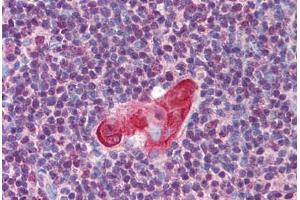 Human Thymus (formalin-fixed, paraffin-embedded) stained with TLX1 antibody ABIN297247 at 5 ug/ml followed by biotinylated goat anti-rabbit IgG secondary antibody ABIN481713, alkaline phosphatase-streptavidin and chromogen. (TLX1 antibody  (AA 300-330, AA 306-318))