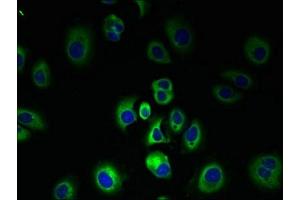 Immunofluorescent analysis of MCF-7 cells using ABIN7147059 at dilution of 1:100 and Alexa Fluor 488-congugated AffiniPure Goat Anti-Rabbit IgG(H+L) (SLC7A3 antibody  (AA 428-475))