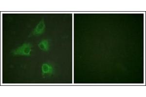 Immunofluorescence analysis of HeLa cells, using DPYSL2 Antibody. (DPYSL2 antibody  (C-Term))