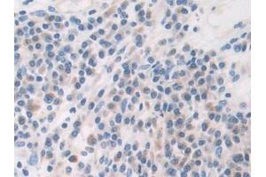 Immunohistochemistry (IHC) image for anti-Calcineurin (CAN) (AA 7-301) antibody (ABIN7433471)