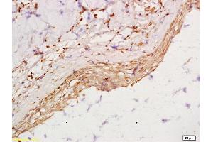 Formalin-fixed and paraffin embedded rat ovary labeled with Anti-RBP/Retinol binding protein Polyclonal Antibody, Unconjugated (ABIN1387728) at 1:200 followed by conjugation to the secondary antibody and DAB staining (Retinol-Binding Protein antibody  (AA 45-135))