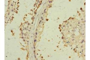 Immunohistochemistry of paraffin-embedded human testis tissue using ABIN7143441 at dilution of 1:100 (BST1 antibody  (AA 29-293))