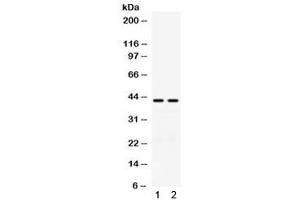 Western blot testing of human 1) A549 and 2) COLO320 cell lysate with RAD51C antibody. (RAD51C antibody)