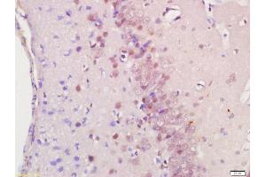 Formalin-fixed and paraffin embedded rat brain labeled with Anti-RASSF8 Polyclonal Antibody, Unconjugated (ABIN762266) at 1:200 followed by conjugation to the secondary antibody and DAB staining (RASSF8 antibody  (AA 101-200))