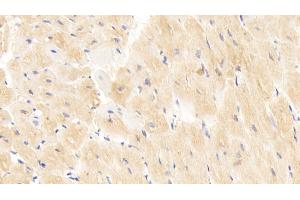 Detection of CD40L in Human Cardiac Muscle Tissue using Polyclonal Antibody to Cluster Of Differentiation 40 Ligand (CD40L) (CD40 Ligand antibody  (AA 1-261))