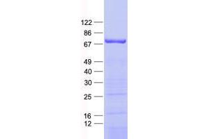 Western Blotting (WB) image for Zinc Finger Protein 549 (ZNF549) protein (His tag) (ABIN2736067)