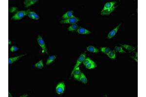 Immunofluorescent analysis of Hela cells using ABIN7169623 at dilution of 1:100 and Alexa Fluor 488-congugated AffiniPure Goat Anti-Rabbit IgG(H+L) (SPPL2A antibody  (AA 26-172))